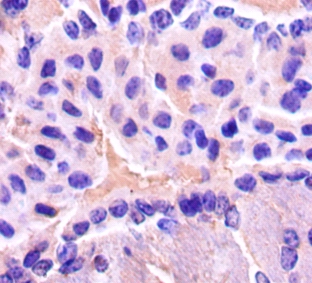 Gamma-enolase Polyclonal Antibody