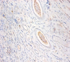 Creatine kinase U-type,mitochondrial Polyclonal Antibody