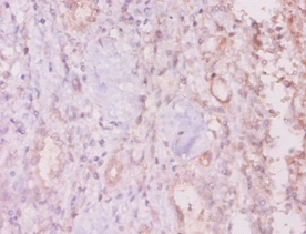 Mucin-16 Polyclonal Antibody