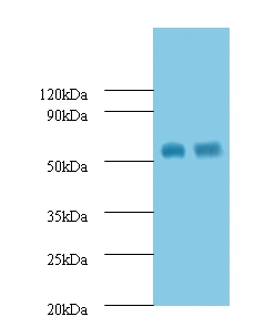 Macrophage metalloelastase Polyclonal Antibody