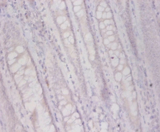 Plasma alpha-L-fucosidase Polyclonal Antibody