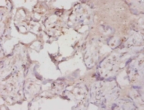 Hypoxia-inducible factor 1-alphaPolyclonal Antibody