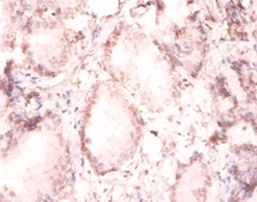 Fibroblast growth factor 2 Polyclonal Antibody