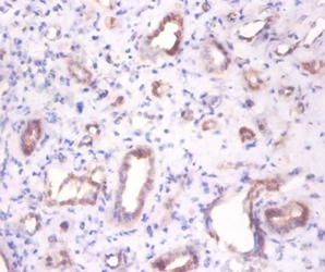 Beta-enolase Polyclonal Antibody