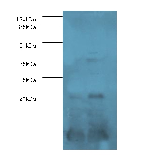 Serum amyloid A-1 protein Polyclonal Antibody