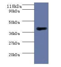 Homocysteine S-methyltransferase 1 Polyclonal Antibody