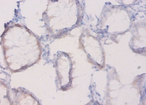 Plexin-A1 Polyclonal Antibody