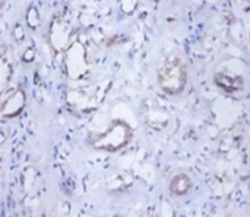 O-phosphoseryl-tRNA(Sec) selenium transferase Polyclonal Antibody
