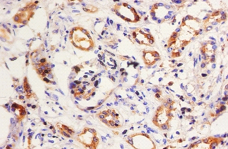Kininogen-1 Polyclonal Antibody