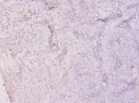 Hypoxanthine-guanine phosphoribosyltransferase Polyclonal Antibody