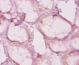 Histone deacetylase 4 Polyclonal Antibody
