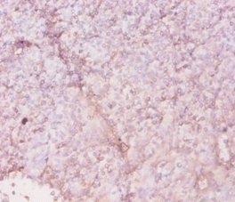 HLA class II histocompatibility antigen, DR alpha chain Polyclonal Antibody
