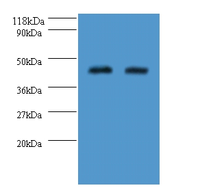Probable sarcosine oxidase Polyclonal Antibody