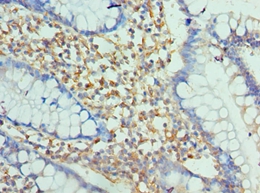 ENPP2 Polyclonal Antibody