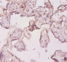 interleukin 18 Polyclonal Antibody
