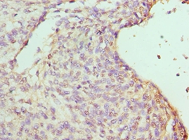 RBBP7 Polyclonal Antibody