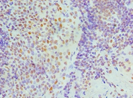 NONO Polyclonal Antibody