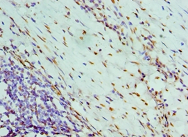 NONO Polyclonal Antibody