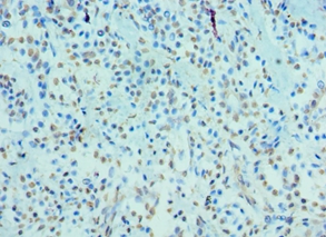 CRY2 Polyclonal Antibody