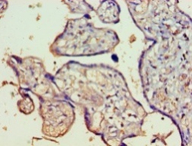 Protein FAM160B1 Polyclonal Antibody