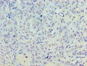 Inactive phospholipase D5 Polyclonal Antibody