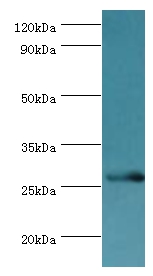 BIRC8 Polyclonal Antibody