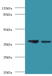 Aldose 1-epimerase Polyclonal Antibody