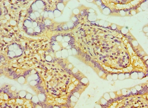 HTATIP2 Polyclonal Antibody
