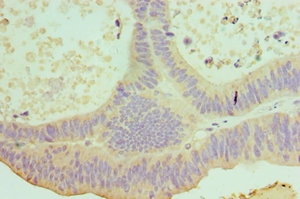 IL22 Polyclonal Antibody
