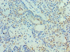 PIAS3 Polyclonal Antibody