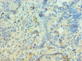 PIAS3 Polyclonal Antibody