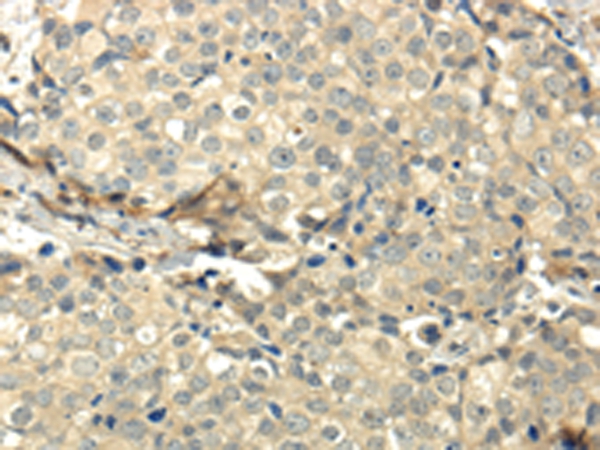 CCL25 Antibody