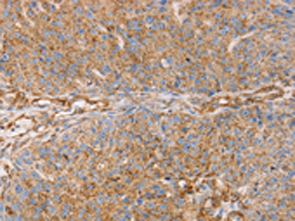 GFAP Antibody