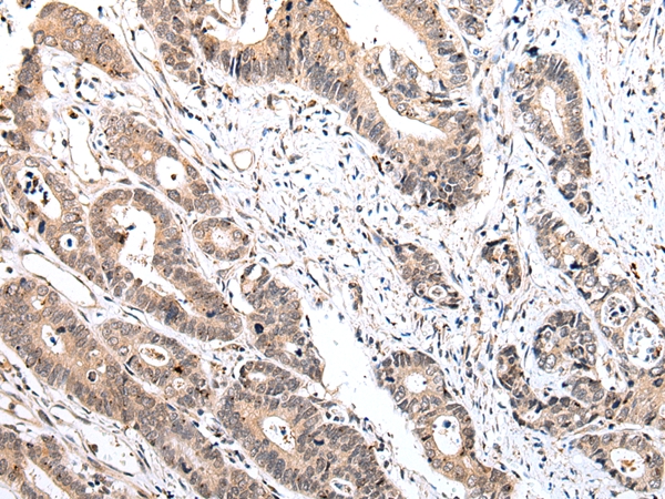 IL15 Antibody