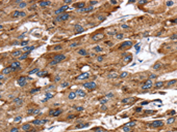 EGLN1 Antibody