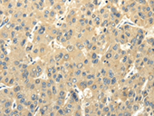 PMP2 Antibody