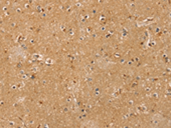 RASSF1 Antibody