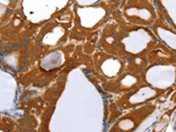 RGS5 Antibody