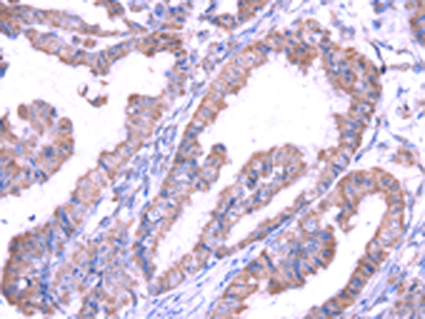 SRPK1 Antibody