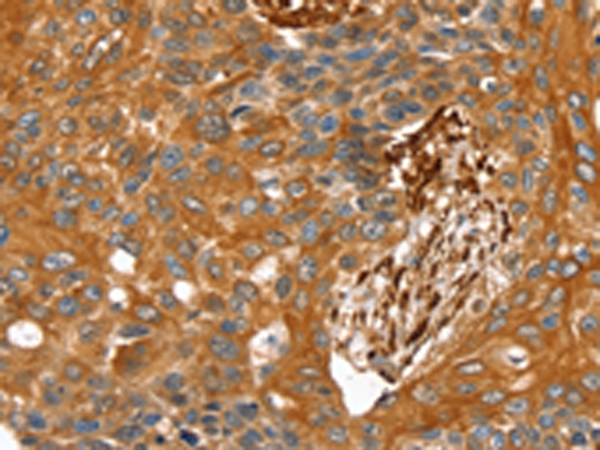 TAGLN Antibody
