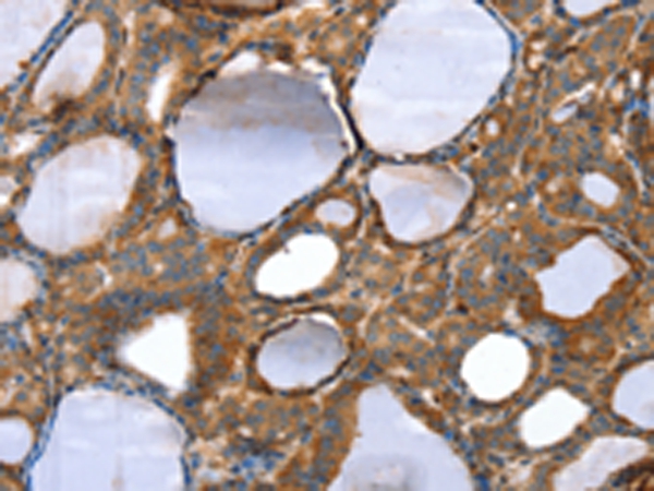 TAGLN Antibody