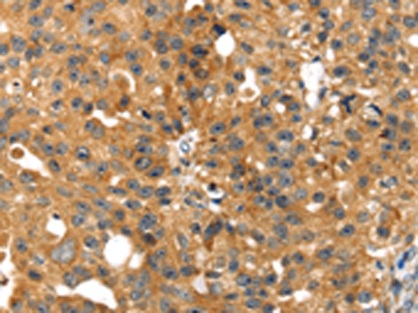 SMYD4 Antibody