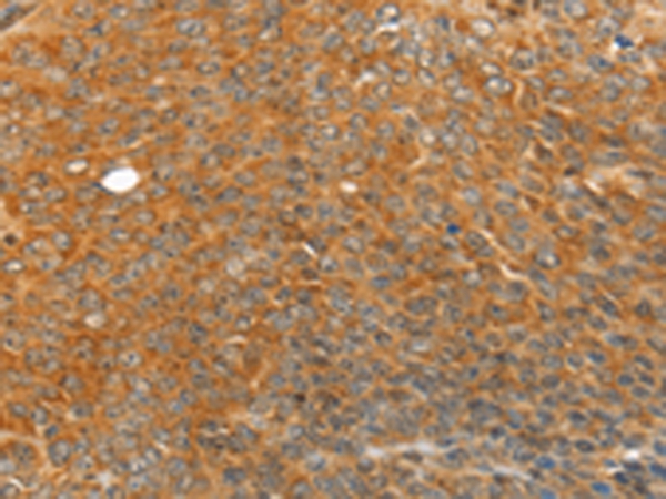 TRIM21 Antibody