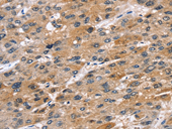 STK33 Antibody
