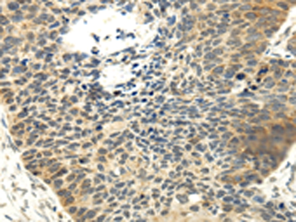 MAP3K7 Antibody