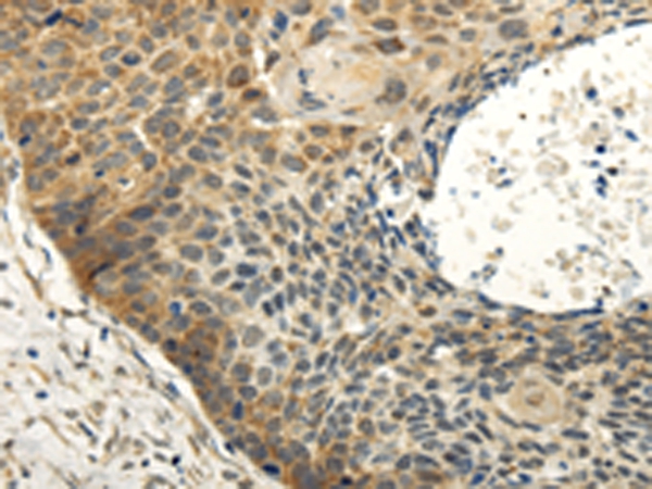 ABCB7 Antibody