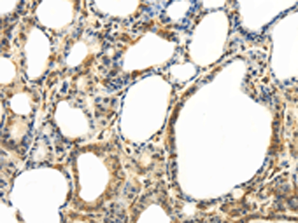 ABCB7 Antibody