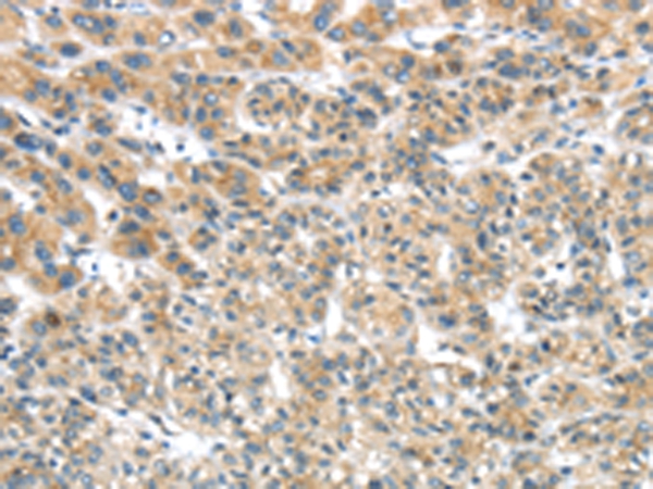TRIM16 Antibody