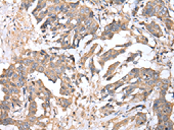 TIMM17A Antibody