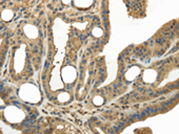 KEAP1 Antibody